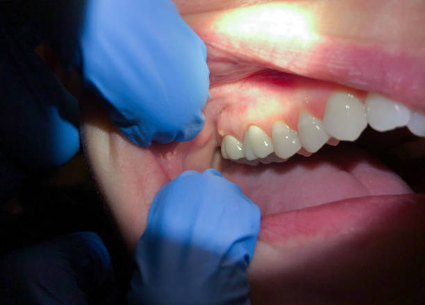 Best 24-Hour Emergency Dentist in Woodlynne, NJ